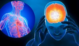 La migraña crónica puede estar asociada a enfermedades cardiovasculares: neuróloga