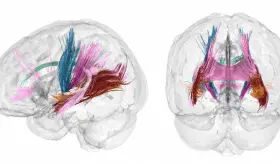 Primer mapa completo de la ´metamorfosis´ cerebral del embarazo