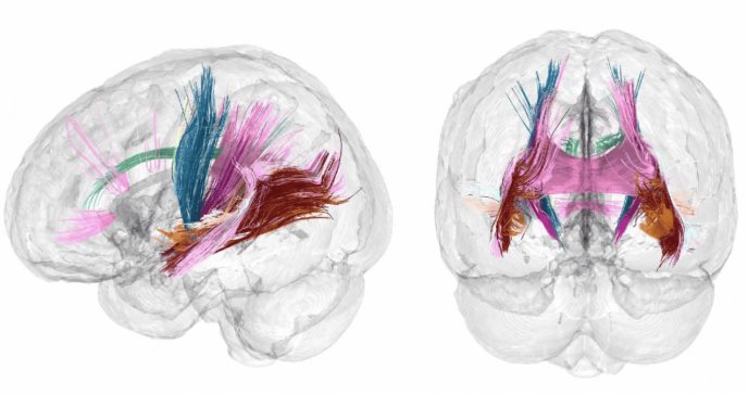 Primer mapa completo de la ´metamorfosis´ cerebral del embarazo