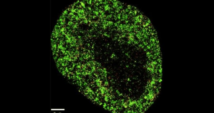 IA con precisión nanométrica es capaz de detectar alteraciones celulares de cáncer e Infecciones virales