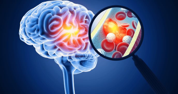 Auricular con láser permite evaluar el riesgo de accidente cerebrovascular