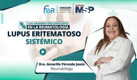 Grandes desconocidos de la reumatología: Lupus eritematoso sistémico