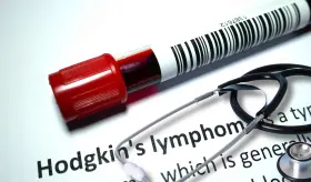 Aumentan la supervivencia del linfoma de Hodgkin avanzado mediante nuevo tratamiento
