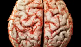 Para el año 2059 se espera un estimado de 150 millones de personas con Alzheimer