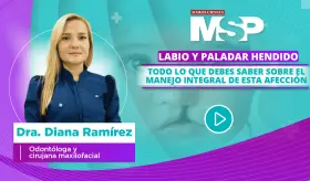 Labio y paladar hendido: Todo lo que debes saber sobre el manejo integral de esta afección