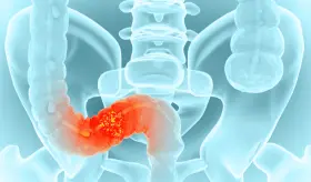 En Estados Unidos se diagnostican 150.000 casos anuales de cáncer de colon y recto, oncólogo Waqqas Tai