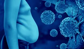 El sobrepeso y la Obesidad aumentan el riesgo de reca&iacute;da en supervivientes de c&aacute;ncer