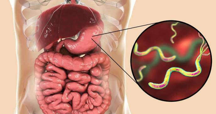 Actualizan guías diagnósticas para la detección de Helicobacter Pylori: Estos son los nuevos enfoques