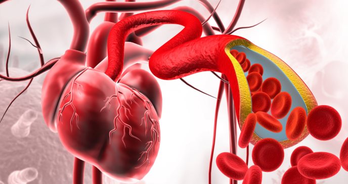 ¿Por qué los síntomas de un infarto son distintos en la población con diabetes? Todo lo que debes saber