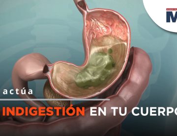 ¿Qué es la indigestión y cómo afecta a tu cuerpo?