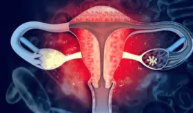 La depresión y los trastornos del sueño podrían estar aumentando el dolor menstrual