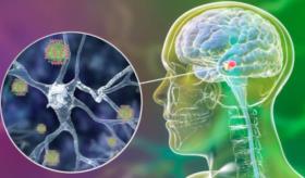 El trastorno del sueño REM puede ser la primer manifestación detectable de párkinson incluso 5 años antes