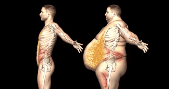 Grasa abdominal es vinculada a signos de alzhéimer 20 años antes de los síntomas, según estudio