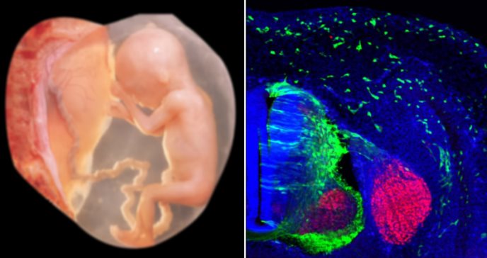 Revelan vínculo entre la comunicación genética del desarrollo craneofacial en los bebés y malformaciones