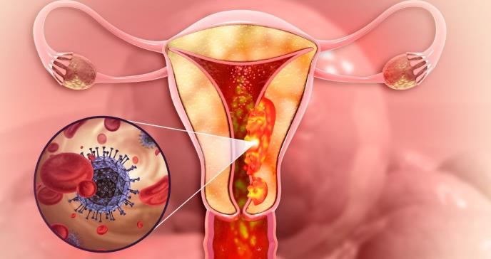 La incidencia más alta de cáncer cervical en EE. UU. se registra entre las mujeres latinas