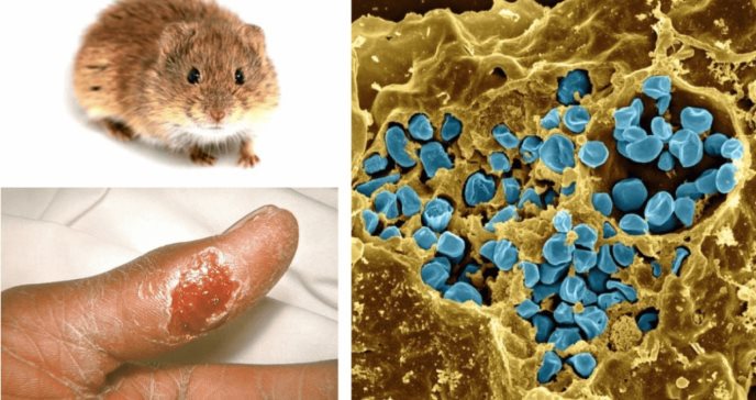 Aumento de casos de tularemia: Enfermedad infecciosa transmitida por roedores, conejos e insectos