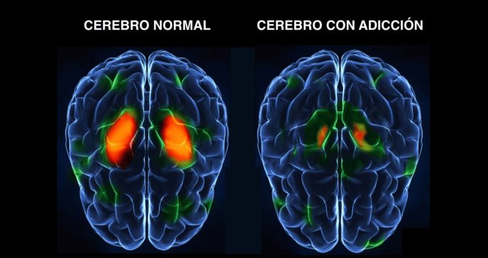 Estudio demuestra que el cerebro de los jóvenes puede indicar el riesgo de adicción antes de que ocurra