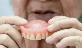 Caries, gingivitis y periodontitis: Cómo afecta el envejecimiento a la salud bucodental
