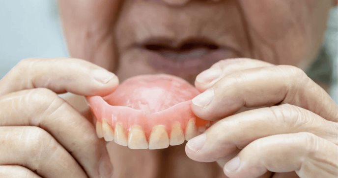 Caries, gingivitis y periodontitis: Cómo afecta el envejecimiento a la salud bucodental