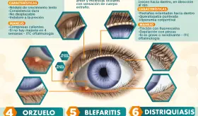 Trastornos de los párpados