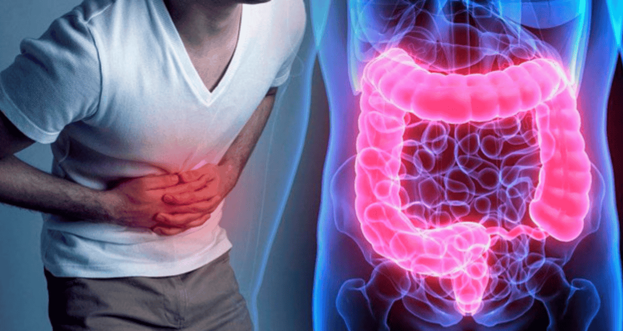 ¿Cómo diferenciar la enfermedad inflamatoria intestinal de otros trastornos gastrointestinales?