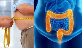 &iquest;Por qu&eacute; los cient&iacute;ficos rechazan el IMC para diagnosticar obesidad? Nuevas formas de diagn&oacute;stico