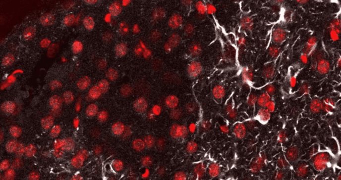 Sonda óptica detecta metástasis cerebral, epilepsia y lesiones traumáticas con precisión molecular