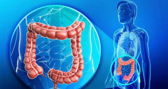 Aumenta la incidencia de cáncer colorrectal en jóvenes en varios países, según estudio