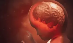 Uso de esteroides durante el embarazo afectaría el desarrollo neurológico y emocional de los niños