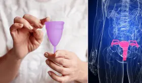 Detectan el primer caso de uterohidronefrosis en una joven por mal uso de la copa menstrual