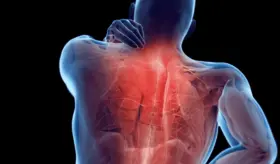 ¿Por qué los nudos musculares causan tanto dolor? Te contamos cómo aliviarlo