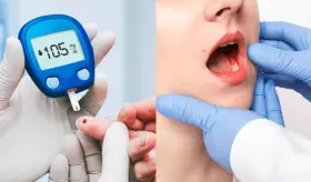 Recomendación clave: Visita dental anual y nuevos enfoques para la enfermedad hepática en diabetes