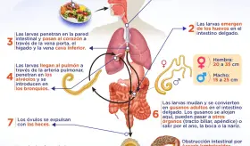 ASCARIS LUMBRICOIDES