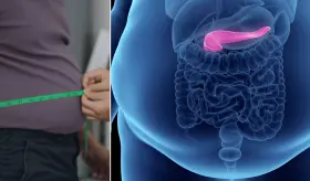1 de cada 6 j&oacute;venes tendr&aacute; obesidad para 2050, predice un an&aacute;lisis global