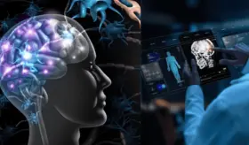 La inteligencia artificial permitirá predecir y frenar la evolución de la Esclerosis Múltiple