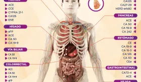MARCADORES TUMORALES