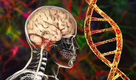 Demencia vascular: Esta es la segunda causa m&aacute;s com&uacute;n de deterioro cognitivo tras el alzh&eacute;imer