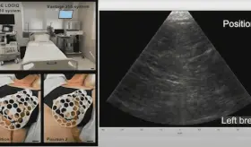 Así funciona el sostén con ultrasonido para detectar cáncer de mama en segundos