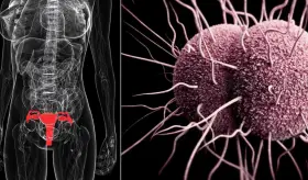 Desarrollan gepotidacina fármaco eficaz para tratar la bacteria Neisseria gonorrhoeae 
