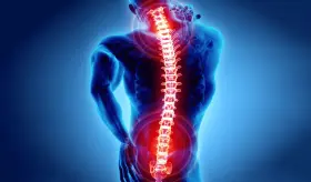 Nuevos criterios para espondiloartritis axial con especificidad del 90 % y mejor sensibilidad