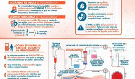 HEMODIÁLISIS: ASPECTOS FUNDAMENTALES DEL TRATAMIENTO RENAL