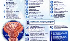 CÁNCER DE PRÓSTATA: PREVENCIÓN Y DETECCIÓN TEMPRANA