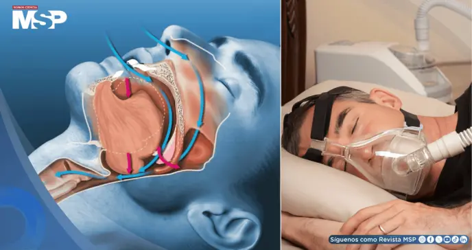 Alteraciones circadianas por altas temperaturas: nuevo factor de aparición de la apnea del sueño