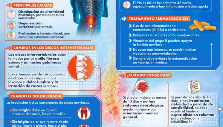 LUMBALGIA AGUDA REPENTINA: CARACTERÍSTICAS CLÍNICAS LUMBALGIA AGUDA REPENTINA: CARACTERÍSTICAS CLÍNICAS