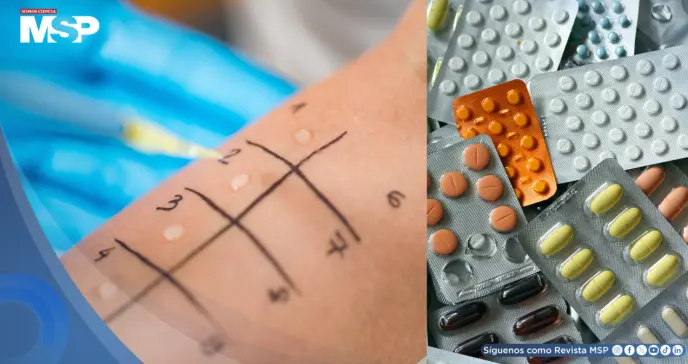 Reacciones alérgicas a medicamentos: ¿Cuáles son las más frecuentes y cómo actuar?   Reacciones alérgicas a medicamentos: ¿Cuáles son las más frecuentes y cómo actuar?
