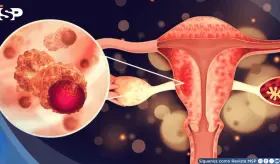 ¿Cansancio extremo durante la menstruación?: Podría ser SOP, trastorno disfórico premenstrual o anemia