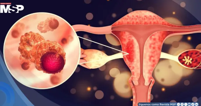 ¿Cansancio extremo durante la menstruación?: Podría ser SOP, trastorno disfórico premenstrual o anemia