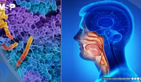 Fusobacterium nucleatum: hallan posible efecto antitumoral de una bacteria común en la boca