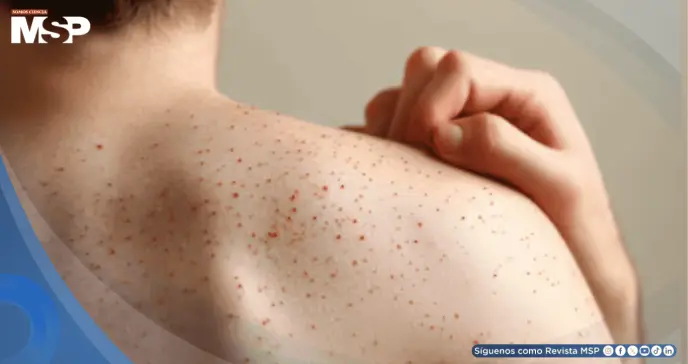 Estados Unidos registra su peor brote de sarampión en más de 30 años con tres muertes confirmadas Estados Unidos registra su peor brote de sarampión en más de 30 años con tres muertes confirmadas