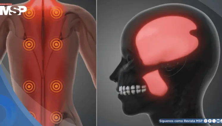 ¿Dolor que no desaparece con el descanso? Podría ser síndrome de dolor miofascial ¿Dolor que no desaparece con el descanso? Podría ser síndrome de dolor miofascial